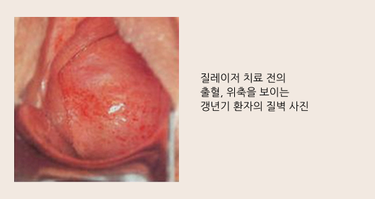 モナリザ 臨床コンセプト